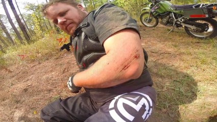 Double Motorcycle Wreck – Guy Breaks His Arm In The Process!